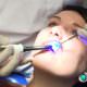 Wie behandel ich als Zahnarzt aus Bochum eine Zahnfleischentzündung?