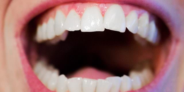Lesen Sie hier, wie Sie Mundgeruch effektiv behandeln können.